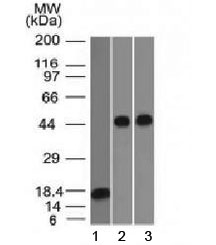 Western blot testing of 1) a partial recombinant protein, 2) human Jurkat and