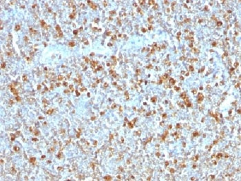 IHC testing of FFPE human tonsil with Alpha 1 Antitrypsin antibody (clone AAT/1379). Required HIER: steam sections in pH6, 10mM citrate buffer for 10-20 min.~