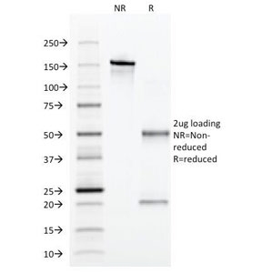 SDS-PAGE Analysis of Purified, BSA-Free Alpha 1 Antitrypsin Antibody (clone AA