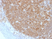 IHC staining of FFPE human tonsil tissue with CD45 antibody (clone F10-89-4). HIER: boil tissue sections in pH 9 10mM Tris with 1mM EDTA for 20 min and allow to cool before testing.