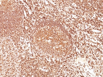 IHC staining of FFPE human tonsil tissue with CD45 antibody (clone F10-89-4). HIER: boil tissue sections in pH 9 10mM Tris with 1mM EDTA for 20 min and allow to cool before testing.~