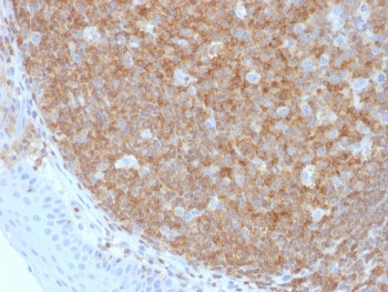 IHC staining of FFPE human tonsil tissue with CD45 ant