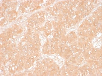 IHC testing of FFPE human adrenal tissue with Perilipin 2 antibody (clone ADFP/1366). Required HIER: steam sections in pH6, 10mM citrate buffer for 10-20 min.~