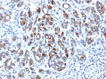 IHC testing of FFPE human pancreas with Alpha-1-Antichymotrypsin antibody (clone AACT/1451). Required HIER: steam sections in pH6, 10mM citrate buffer for 10-20 min.~