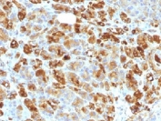 IHC testing of FFPE human pancreas with Alpha-1-Antichymotrypsin antibody cocktail (clone AACT/1451 + AACT/1452). Required HIER: steam sections in pH6, 10mM citrate buffer for 10-20 min.