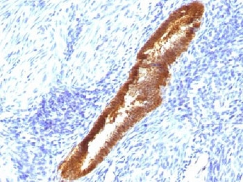 IHC testing of FFPE human endometrium with ASRGL1 antibody (clone CRASH/1289). Required HIER: steam sections in 10mM Tris with 1mM EDTA, pH9, for 10-20 min.~