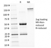 SDS-PAGE Analysis of Purified, BSA-Free ASRGL1 Antibody (clone CRASH/1289). Confirmation of Integrity and Purity of the Antibody.