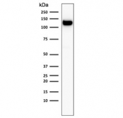 Western blot testing of human MCF-7 cell lysate with E-Cadherin antibody (clone 4A2). Expected molecular weight: 135 kDa (precursor), 80-120 kDa (mature, depending on glycosylation level).