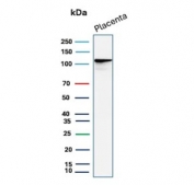 Western blot testing of human placental tissue lysate with E-Cadherin antibody (clone 4A2). Expected molecular weight: 135 kDa (precursor), 80-120 kDa (mature, depending on glycosylation level).