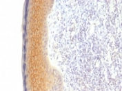 IHC testing of FFPE human skin with Plakoglobin antibody (clone CTNG/1483). Required HIER: boil tissue sections in 10mM Tris with 1mM EDTA, pH 9, for 10-20 min.