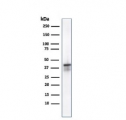 Western blot testing of human kidney lysate with AMACR antibody (clone AMACR/1723). Predicted molecular weight ~43 kDa.