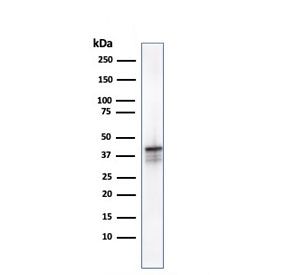 Western blot testing of human kidney lysate with AMACR antibody. Predicted molecular weight ~43 kDa.
