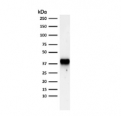 Western blot testing of human PC3 cell lysate with AMACR antibody (clone AMACR/1723). Predicted molecular weight ~43 kDa.