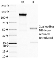 BRCA1 Antibody Purity SDS-PAGE. SDS-PAGE analysis of purified BRCA1 antibody clone BRCA1/1398 demonstrating antibody integrity and purity under non-reducing (NR) and reducing (R) conditions. Under non-reducing conditions, the antibody migrates predominantly as an intact immunoglobulin species near approximately 150 kDa. Under reducing conditions, characteristic heavy and light chain bands are observed near approximately 50 kDa and 25 kDa, respectively, consistent with expected monoclonal antibody structure following disulfide bond reduction.