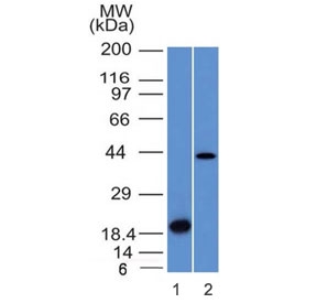 Western blot testing of 1) a partial recombinant protein and 2) human liver lysate with Aurora B antibody (clone AURKB/1521). Predicted molecular weight: 39-45 kDa~