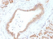 IHC testing of FFPE human pancreas tissue with Beta Catenin antibody (clone CTNNB1/1507). Required HIER: boil tissue sections in 10mM Tris with 1mM EDTA, pH 9.0, for 10-20 min.