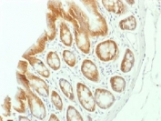 IHC testing of FFPE rat colon tissue with Beta Catenin antibody (clone CTNNB1/1507). Required HIER: boil tissue sections in 10mM Tris with 1mM EDTA, pH 9.0, for 10-20 min.