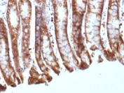 IHC testing of FFPE mouse colon tissue with Beta Catenin antibody (clone CTNNB1/1508). Required HIER: boil tissue sections in 10mM Tris with 1mM EDTA, pH 9.0, for 10-20 min.