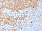 IHC testing of FFPE human tonsil tissue with Beta Catenin antibody (clone CTNNB1/1508). Required HIER: boil tissue sections in 10mM Tris with 1mM EDTA, pH 9.0, for 10-20 min.