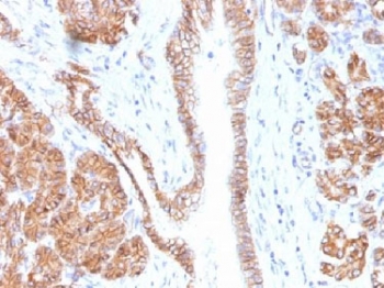 IHC testing of FFPE human pancreas tissue with Beta Catenin antibody (clone CTNNB1/1508). Required HIER: boil tissue sections in 10mM Tris with 1mM EDTA, pH 9.0, for 10-20 min.~