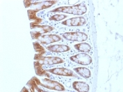 IHC testing of FFPE rat colon tissue with Beta Catenin antibody (clone CTNNB1/1508). Required HIER: boil tissue sections in 10mM Tris with 1mM EDTA, pH 9.0, for 10-20 min.