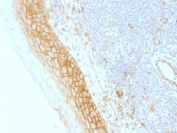 IHC testing of FFPE human tonsil tissue with b-Catenin antibody (clone CTNNB1/1509). Required HIER: boil tissue sections in 10mM Tris with 1mM EDTA, pH 9.0, for 10-20 min.