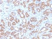IHC testing of FFPE human pancreas tissue with b-Catenin antibody (clone CTNNB1/1509). Required HIER: boil tissue sections in 10mM Tris with 1mM EDTA, pH 9.0, for 10-20 min.