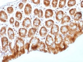 IHC testing of FFPE mouse colon tissue with b-Catenin antibody (clone CTNNB1/1509). Required HIER: boil tissue sections in 10mM Tris with 1mM EDTA, pH 9.0, for 10-20 min.~