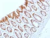 IHC testing of FFPE rat colon tissue with b-Catenin antibody (clone CTNNB1/1509). Required HIER: boil tissue sections in 10mM Tris with 1mM EDTA, pH 9.0, for 10-20 min.
