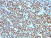 IHC testing of CD20 antibody and FFPE human tonsil tissue. Required HIER: steam section in pH6 citrate buffer for 20 min.