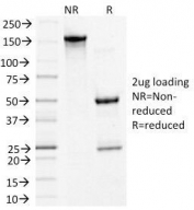 SDS-PAGE Analysis of Purified, BSA-Free Desmoglein 3 Antibody (clone 5G11). Confirmation of Integrity and Purity of the Antibody.