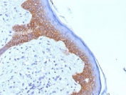 IHC testing of FFPE human skin with Desmoglein 3 antibody (clone 5G11). Required HIER: boil tissue sections in 10mM citrate buffer, pH 6, for 10-20 min.