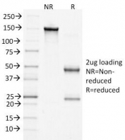 SDS-PAGE Analysis of Purified, BSA-Free Beta Catenin Antibody (clone 15B8). Confirmation of Integrity and Purity of the Antibody.