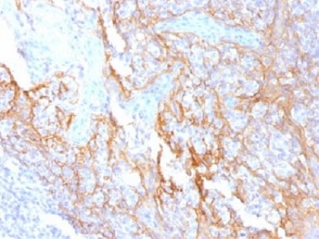 IHC testing of FFPE human tonsil tissue with Beta Catenin antibody (clone 15B8). Required HIER: boil tissue sections in 10mM Tris with 1mM EDTA, pH 9.0, for 10-20 min.~