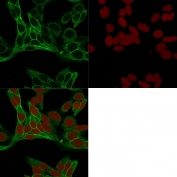 Immunofluorescent staining of human HeLa cells with Cytokeratin 18 antibody (clone 15B8, green) and Reddot nuclear stain (red).