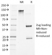 SDS-PAGE Analysis of Purified, BSA-Free Beta Catenin Antibody (clone 5H10). Confirmation of Integrity and Purity of the Antibody.