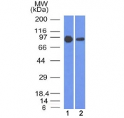 Western blot testing of human 1) A431 and 2) A549 cell lysate with Beta Catenin antibody (clone 5H10). Predicted molecular weight ~85 kDa, but routinely observed at 90-95 kDa.