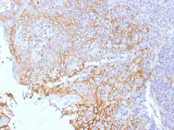 IHC testing of FFPE human tonsil tissue with Beta Catenin antibody (clone 5H10). Required HIER: boil tissue sections in 10mM Tris with 1mM EDTA, pH 9.0, for 10-20 min.~