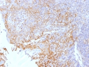 IHC testing of FFPE human tonsil tissue with Beta Catenin antibody (clone 5H10). Required HIER: boil tissue sections in 10mM Tris with 1mM EDTA, pH 9.0, for 10-20 min.