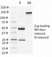 SDS-PAGE Analysis of Purified, BSA-Free b-Catenin Antibody (clone 6F9). Confirmation of Integrity and Purity of the Antibody.