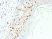 IHC testing of FFPE human skin with CD1a antibody. Required HIER: boil tissue sections in 10mM citrate buffer, pH 6, for 10-20 min.