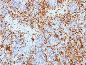 IHC testing of FFPE human spleen tissue with CD61 antibody (clone Y2/51). Required HIER: boil tissue sections in 10mM Tris with 1mM EDTA, pH 9.0, for 10-20 min.~