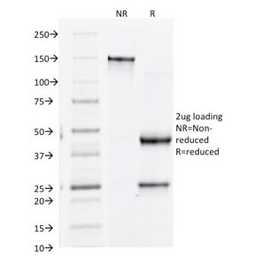 SDS-PAGE Analysis of Purified, BSA-Free CD61 Antibody (clone Y2/51). Confir