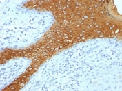 IHC testing of FFPE human skin with Keratin 10 antibody cocktail (KRT10/844). Required HIER: boil tissue sections in 10mM citrate buffer, pH 6, for 10-20 min.
