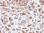 IHC testing of FFPE human pancreas with CFTR antibody (clone SPM176). HIER: boil tissue sections in 10mM Tris with 1mM EDTA, pH 9, for 10-20 min.