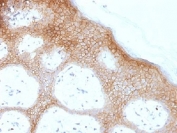 IHC testing of FFPE human skin with Desmoglein 1 antibody (clone DSG1/1733). Required HIER: boil tissue sections in 10mM Tris buffer with 1mM EDTA, pH 8, for 10-20 min.