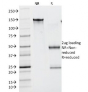 SDS-PAGE Analysis of Purified, BSA-Free Lambda Light Chain Antibody (clone N10/2). Confirmation of Integrity and Purity of the Antibody.