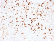 IHC testing of FFPE human tonsil stained with Lambda Light Chain antibody (clone N10/2). Required HIER: boil tissue sections in 10mM citrate buffer, pH 6, for 10-20 min.