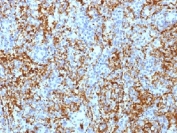 IHC testing of FFPE human spleen tissue with Integrin beta 3 antibody (clone ITGB3/1713). Required HIER: boil tissue sections in 10mM Tris with 1mM EDTA, pH 9.0, for 10-20 min.
