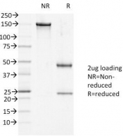 SDS-PAGE Analysis of Purified, BSA-Free DSG1 Antibody (clone 27B2). Confirmation of Integrity and Purity of the Antibody.